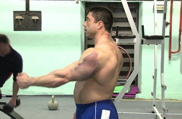 Спортивная медицина - Бодибилдинг форум AnabolicShops