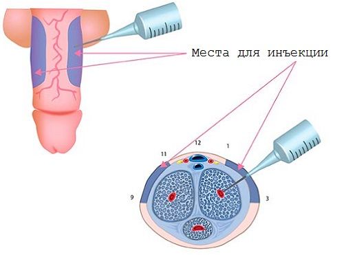 Папаверин. Инструкция по применению. - Бодибилдинг форум AnabolicShops