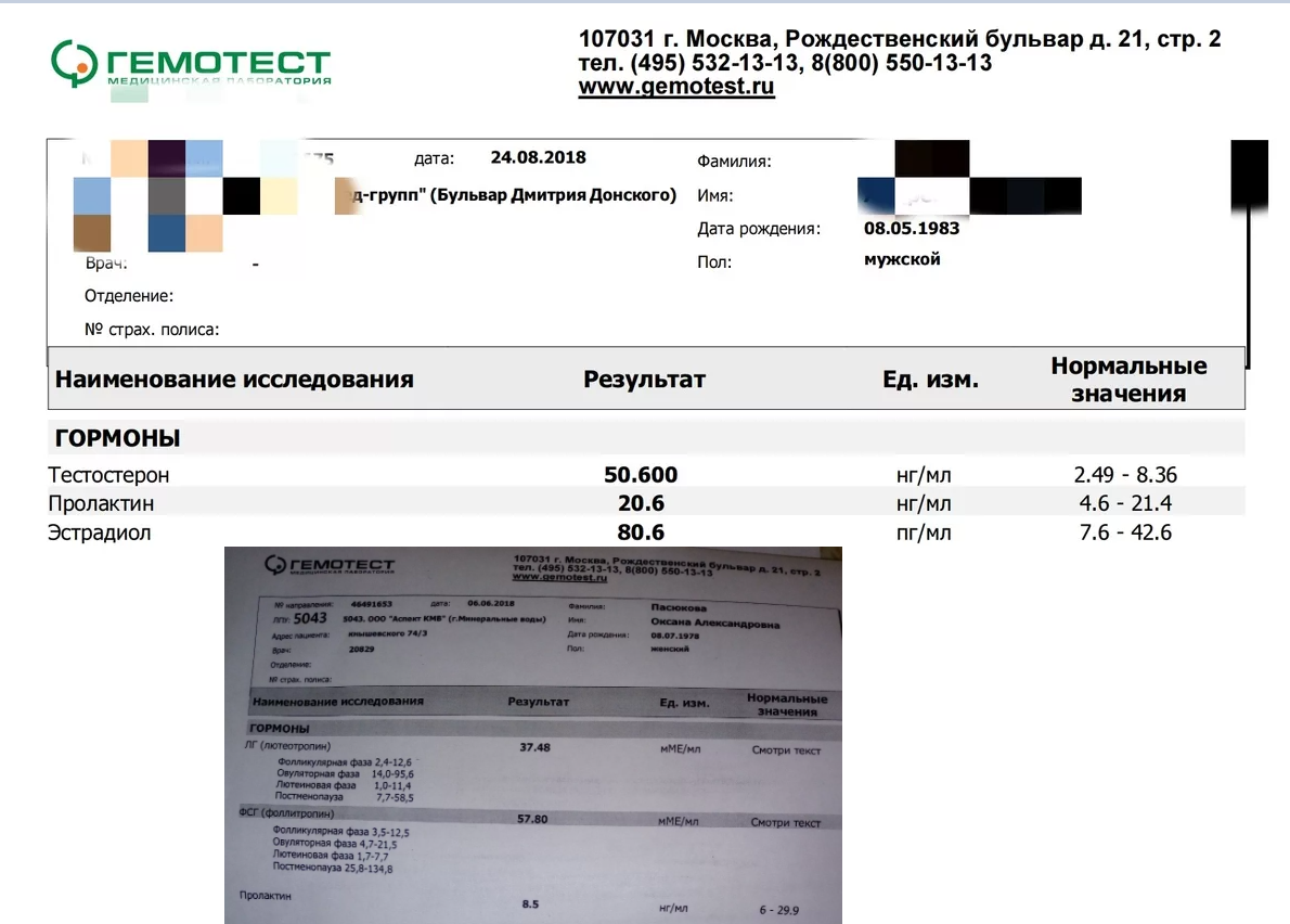 Стаж 10 лет, 5 лет нет прогресса, интересно мнение - Бодибилдинг форум AnabolicShops