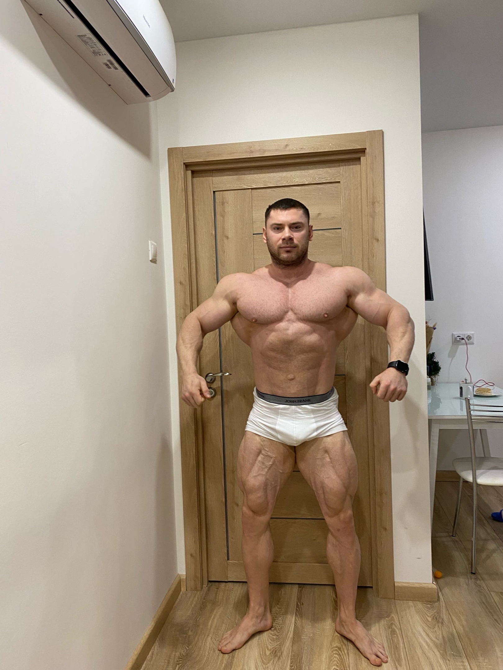 Пупочная грыжа. Сетка. - Бодибилдинг форум AnabolicShops