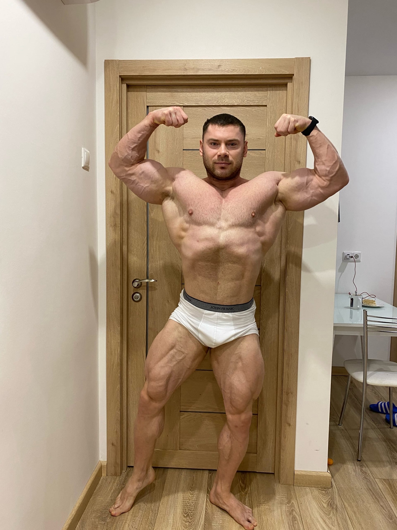 Пупочная грыжа. Сетка. - Бодибилдинг форум AnabolicShops