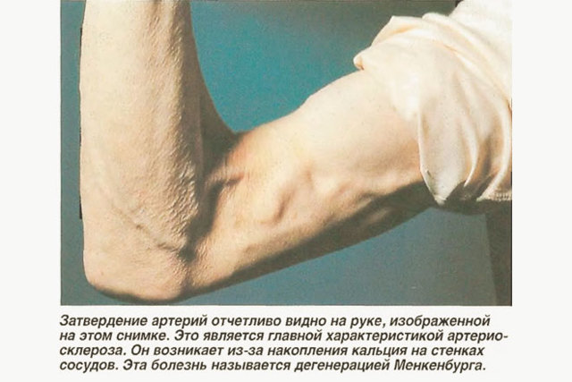 Homosteron.com оф.дилер Zphc|CanadaPeptides|Ergo Mrc - Бодибилдинг форум AnabolicShops