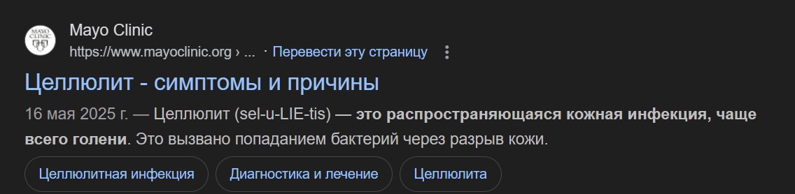 Из-за укуса комара бодибилдер чуть не лишился ноги и внутренних органов - Бодибилдинг форум AnabolicShops