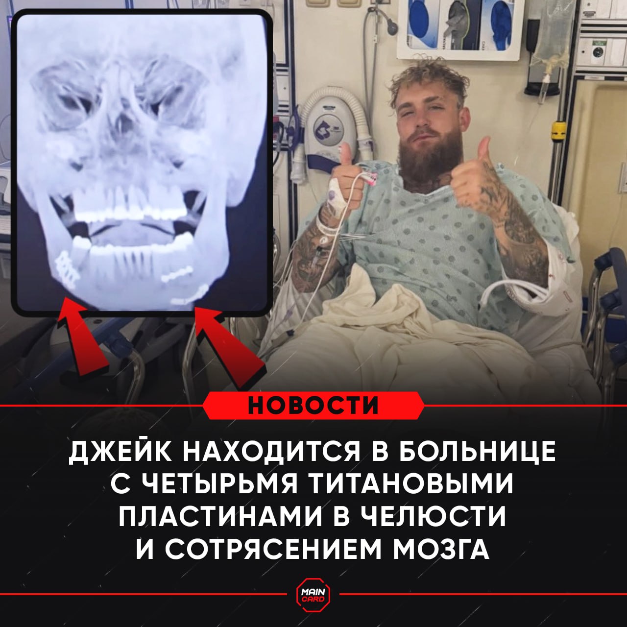Новости из мира ММА и единоборств - Бодибилдинг форум AnabolicShops