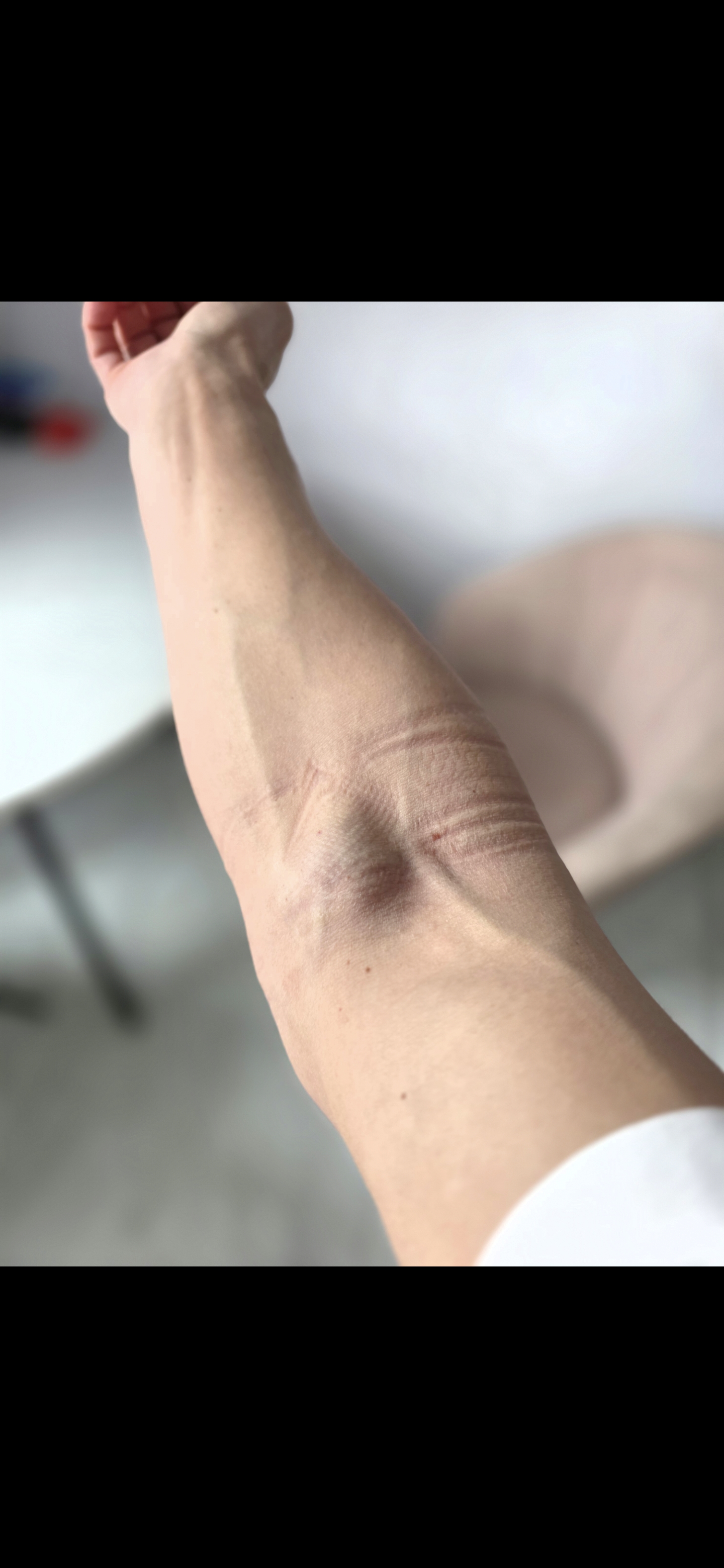 RoidTeam - Дистрибьютор Hilma Biocare и HGH Marten в России - Бодибилдинг форум AnabolicShops
