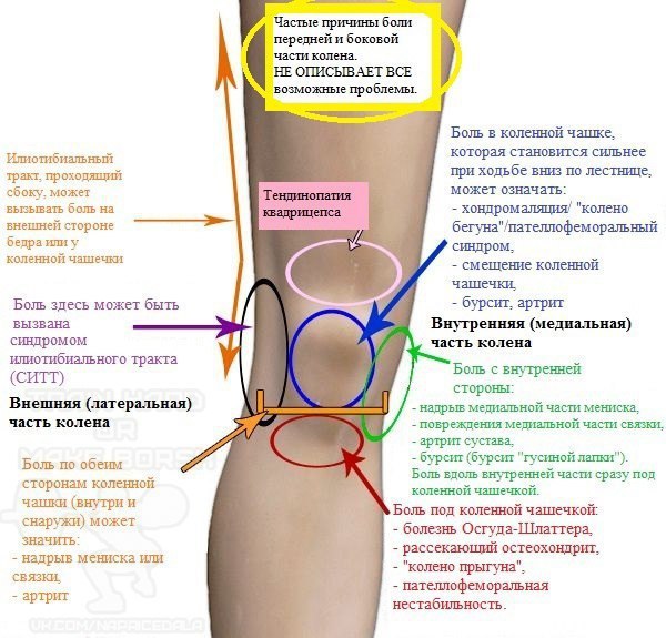 Боль в области чуть ниже колена - Бодибилдинг форум AnabolicShops