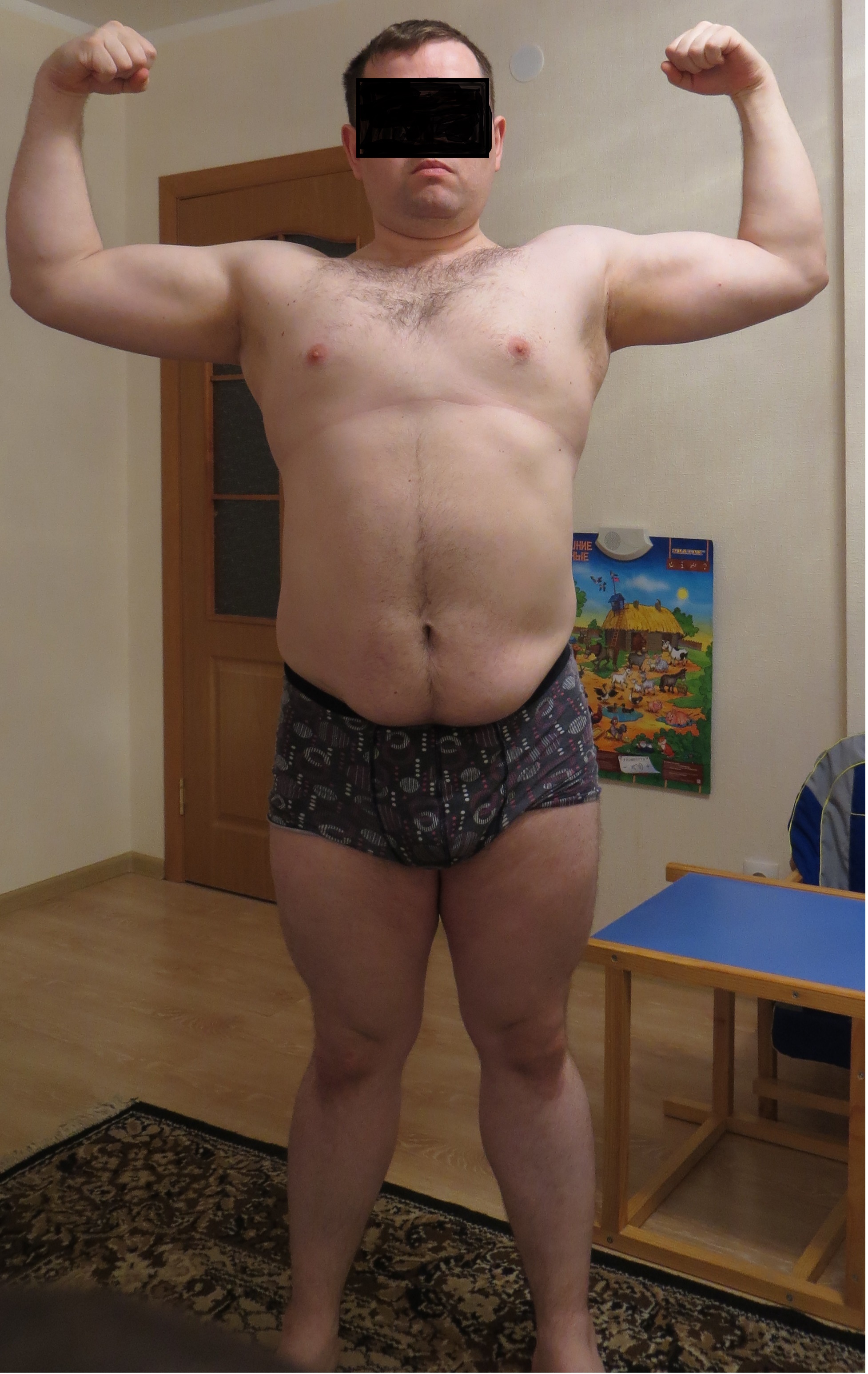 История болезни - Бодибилдинг форум AnabolicShops