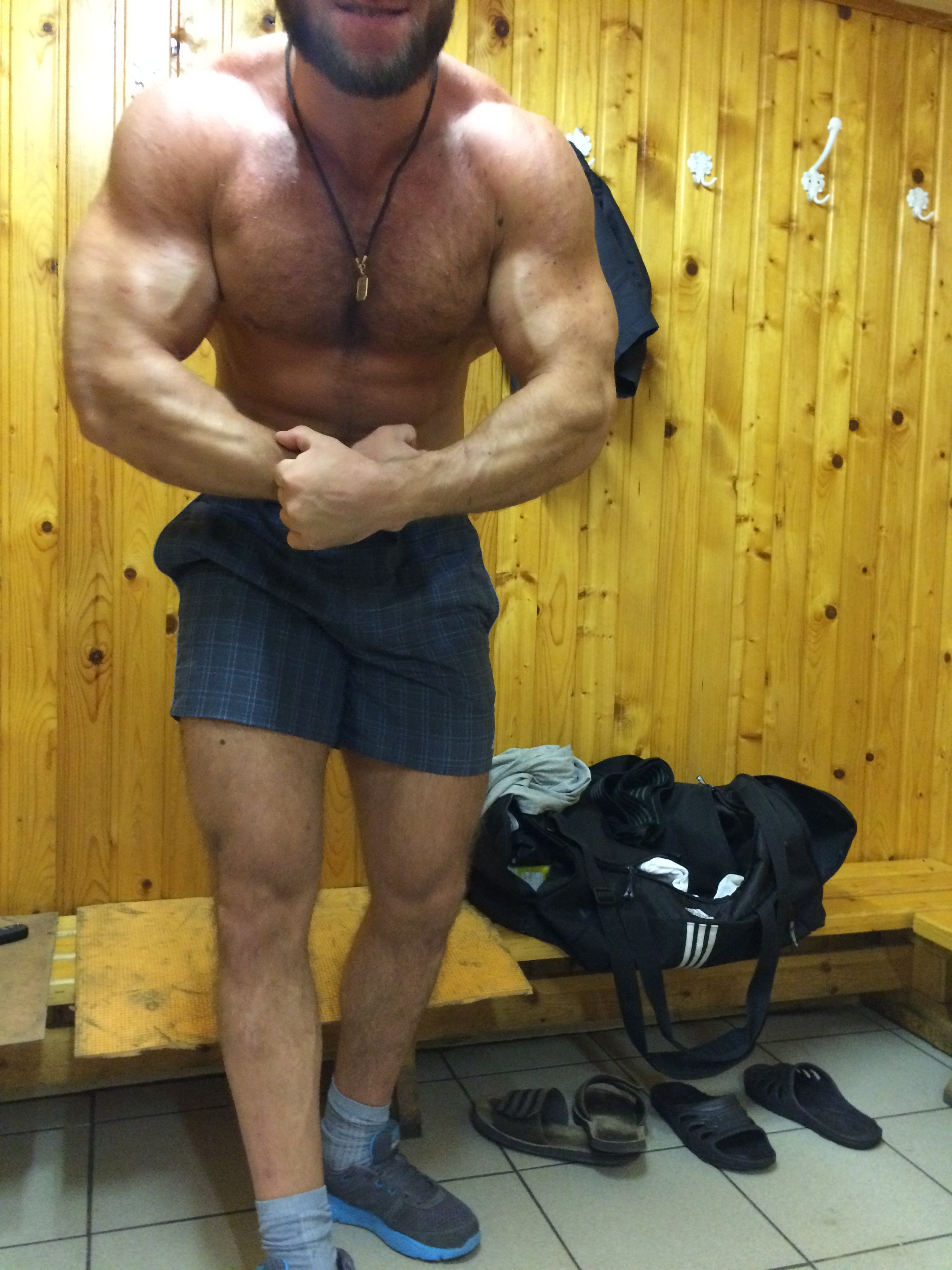 Как "СanadaPeptides" ногу залечила=] - Бодибилдинг форум AnabolicShops
